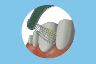 MultilinelP-type